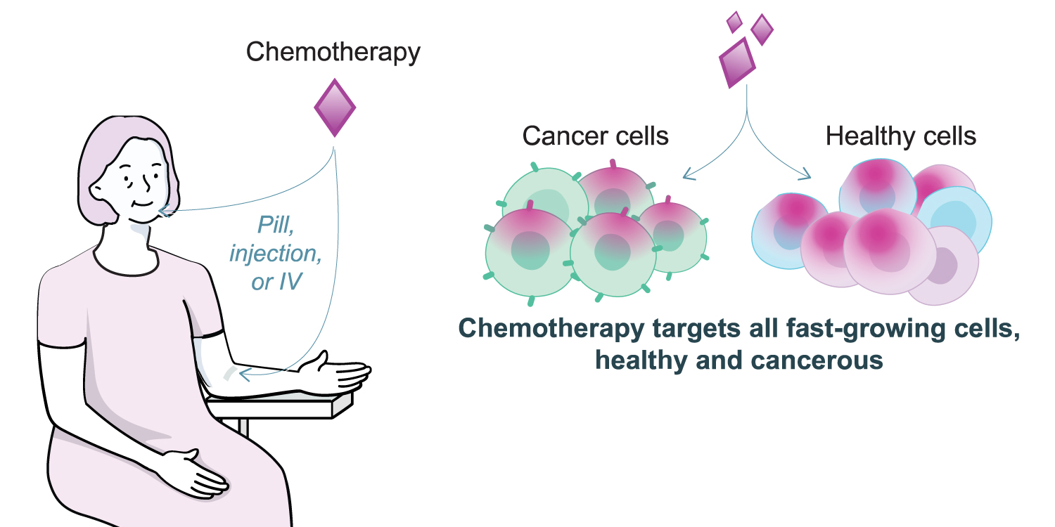Illustration showing a woman receiving Chemotherapy through pill, injection, or IV. Chemotherapy targets all fast-growing cells, health, and cancerous.