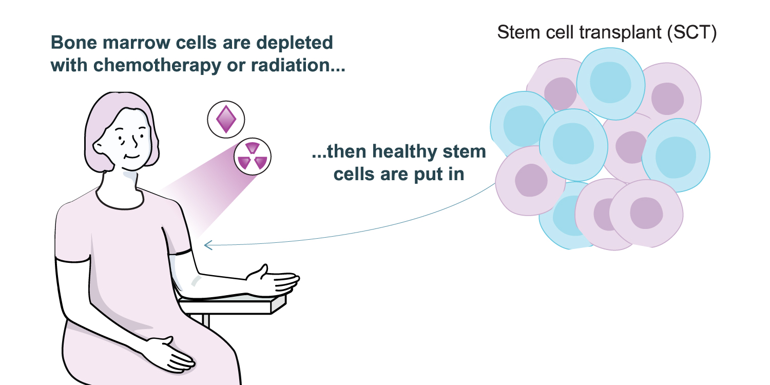Illustration showing a woman with the description bone marrow cells are depleted with chemotherapy or radiation…then healthy stem cells are put in.