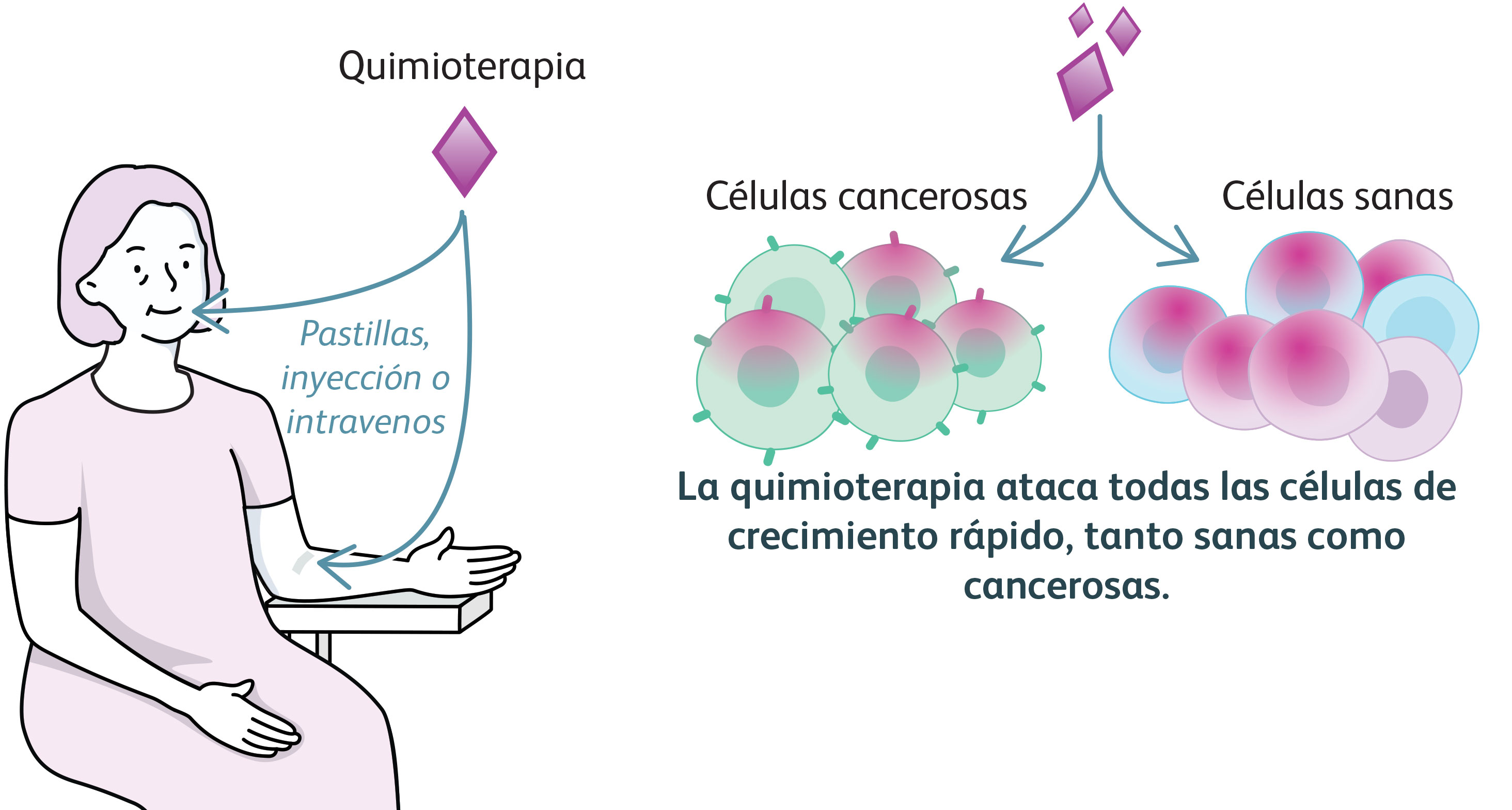 Ilustración que muestra a una mujer recibiendo quimioterapia en forma de pastillas, inyección o intravenosa. La quimioterapia ataca todas las células de crecimiento rápido, tanto sanas como cancerosas.