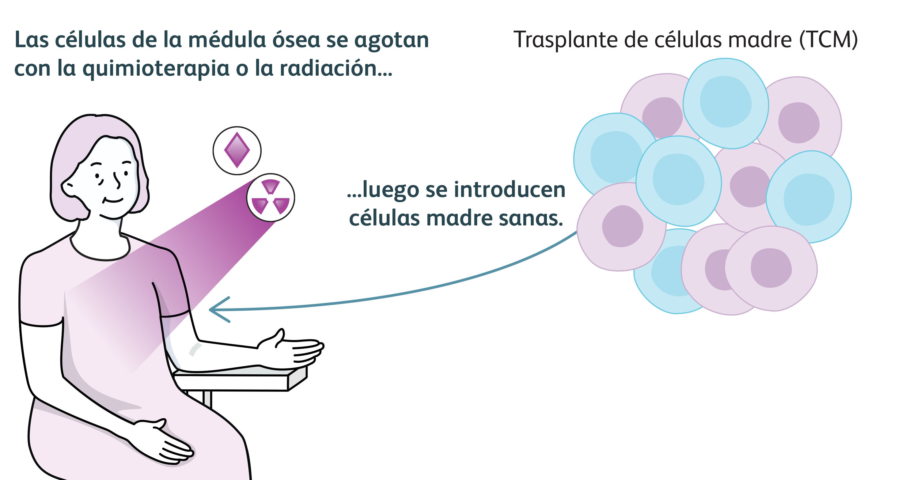 Ilustración que muestra a una mujer con la descripción de que las células de la médula ósea se agotan con la quimioterapia o la radiación... y luego se introducen células madre sanas.